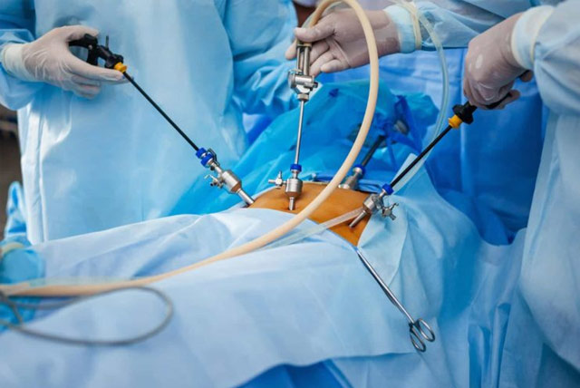 Cirugía laparoscopia