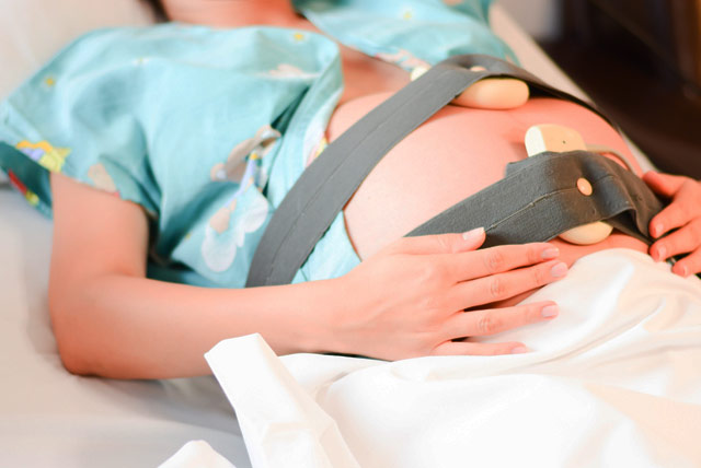 Monitoreo Fetal Ante parto